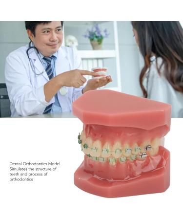 Portable Orthodontic Bracket Model - Simulated Safe Dental Resin for Students & Hospitals | International Shipping - Buy Online on GoSupps.com
