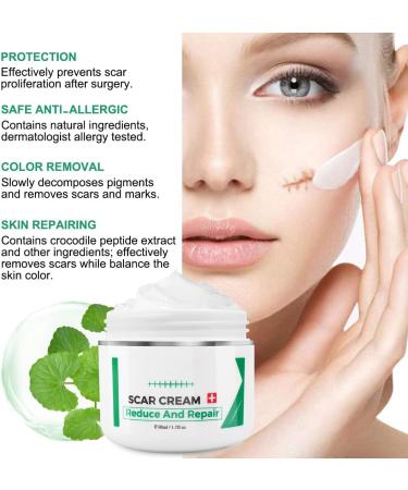 Aliver Scar Removal Cream - Stretch Mark & Acne Remover for Men & Women - Effective Treatment for Old & New Scars, Cuts, and Keloids - Buy Online on GoSupps.com