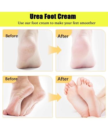  TJITGY 2025 New Urea Cream 60% + Moisturizing and Anti-Cracking Cream Repairing Cream for Feet and Hands Foot Cream for Cracked Heels and Dry Skin - Buy Online on GoSupps.com