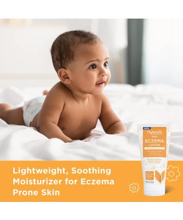 Hyland's Baby Eczema Lotion | Lightweight Moisturizer with Colloidal Oatmeal | Soothes Eczema-Prone Skin | 5 oz International Shipping - Buy Online on GoSupps.com