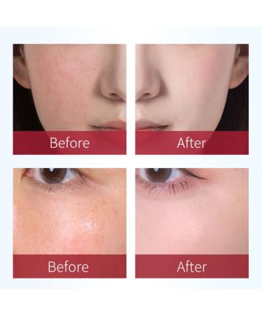 Rosaderm Fast Gel Cream Skin Tint Corrective Anti Redness Primer 30g - Buy Online on GoSupps.com