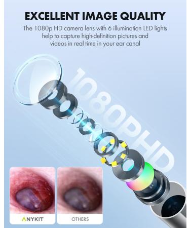 Anykit Digital Otoscope - HD Ear Camera with Gyroscope & Wax Removal Tools Compatible with iPhone 15 & Android - Clear Video Scope (Silver - Buy Online on GoSupps.com