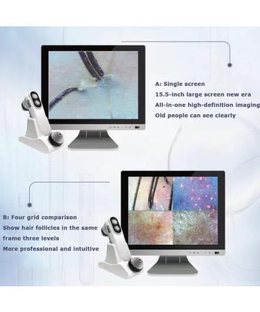 SDTOOP 15.5 Inch HD LCD Screen Microscope Tester for Hair Follicles Facial Skin Oil Moisture Health Detection Machine for Home Salon Use - Buy Online on GoSupps.com