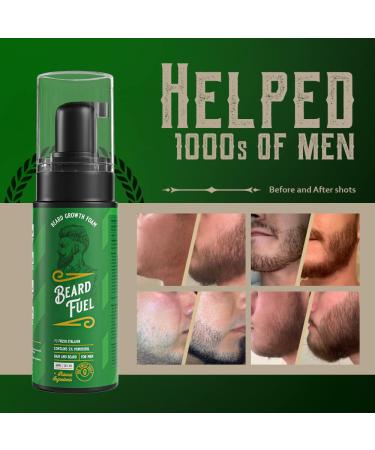 Beard Growth Foam 5% Minoxidil with Biotin - 3 Month Supply | Beard Fuel Hair Follicle Growth | Extra Natural Ingredients for Men (60ml) - Buy Online on GoSupps.com