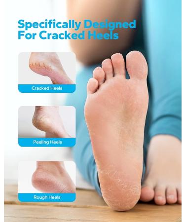 MoistMate Heel Socks for Dry Cracked Feet - Foot Care Repair and Moisturizing - Aloe Spa Socks for Men and Women (Grey, 2 Pairs) - Buy Online on GoSupps.com