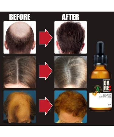 Mrinb Hair Growth Serum - Ginger Oil for Accelerated Hair Growth & Beard Growth | 30ml Unisex Solution Against Hair Loss - Buy Online on GoSupps.com