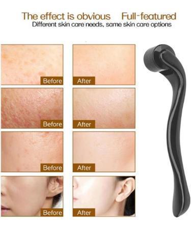 Dermaroller Hair 1.5 mm - Dermaroller Face Dermaroller Hair with 540 Stainless Steel Micro Needles Derma Roller for Microneedling Beard Growth for Scars Wrinkles - Buy Online on GoSupps.com