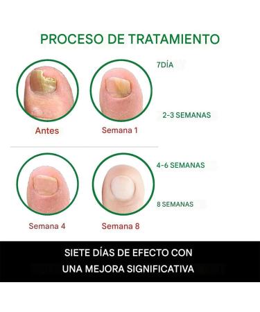 Gel for damaged nails | Repairing cream 20 ml for damaged and yellowed toenails moisturizing treatment for thick hard sensitive dry and cracked nails for daily use at home - Buy Online on GoSupps.com