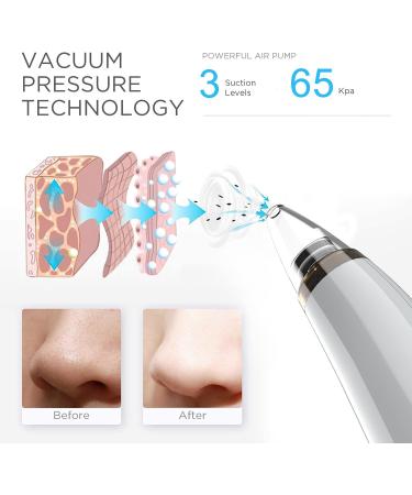 Blackhead Remover Pore Vacuum Cleaner with 5 Probes - Electric USB Facial Cleaner for Blackhead Suction - Upgraded Blackhead Remover Kit in Light White - Buy Online on GoSupps.com