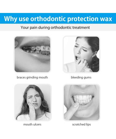 10 Pieces Orthodontic Wax for Braces - 50 Strips Dental Wax with 10 Flavors for Pain Relief & Irritation - Buy Online on GoSupps.com