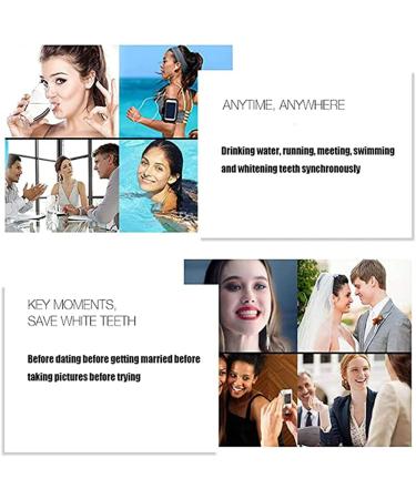 Frenzify Artificial Teeth Set - DIY Comfortable Upper & Lower Dentures for Adults - White Plug-In False Teeth - Buy Online on GoSupps.com