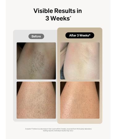 Ulike Air 3 IPL Hair Removal with Ice-Cooling System - Painless & Long-Lasting Results for Women and Men - Body & Face At-Home Use - Buy Online on GoSupps.com