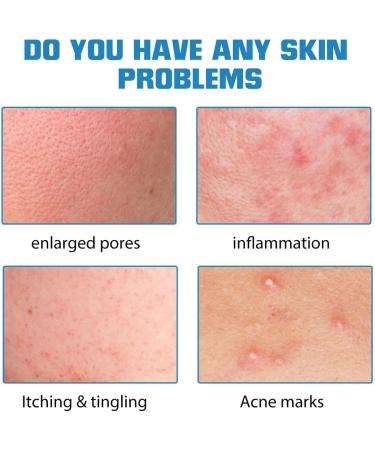 3pcs Micro infusion system for face Micro Infusion System for Lips Micro Infusion Facial System Smooth Skin Facial Serum for All Skin Types - Buy Online on GoSupps.com