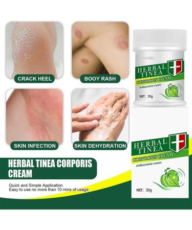 Zuicc Herbal Tinea Corporis Cream - Natural Itching Relief & Moisturizer for Tinea Dry Skin and Eczema Care - Buy Online on GoSupps.com