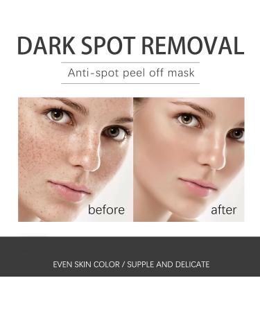 Dark Spot Remover for Face Hyaluronic Acid Dark Spot Correcting Serum Anti Aging Face Serum for Women Nicotinamide Dark Spot Correcting Glow Serum Anti Spot Face Serum and Oil Skin Moisturizer-30ml - Buy Online on GoSupps.com