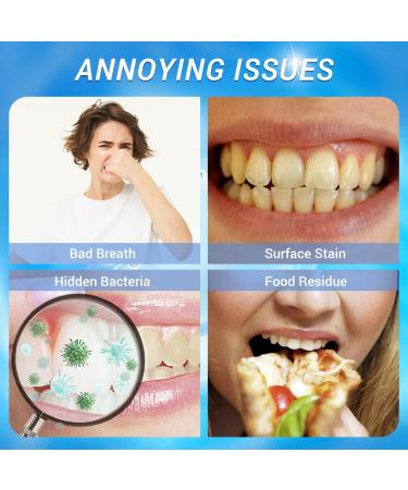 BodyAccel Nicotinamide Dazzle White Toothpaste - Fresh Breath Sensitive Teeth Repair Cavity Prevention Antiplaque Natural Peppermint - International Shipping Available - Buy Online on GoSupps.com