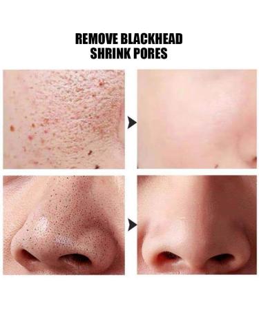 Silk Ball Facial Cleanser Balls - 30pcs Silkworm Face Cleansing Tool for Home Beauty & Skin Care - Buy Online on GoSupps.com