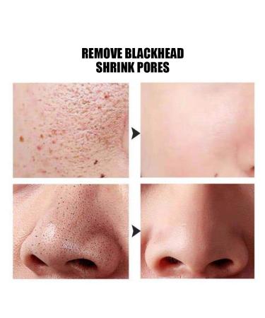 Organic Silkworm Silk Balls for Blackhead Removal - 30pcs Makeup Removal & Exfoliating Skincare - Buy Online on GoSupps.com