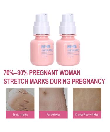 2-Piece 40g Postpartum Stretch Mark Cream | Natural Scar Fading & Nourishing Massage Cream for Women - Buy Online on GoSupps.com