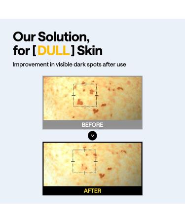 MEDIHEAL Vitamin C Brightening Serum & Mask Skin Care Duo Set for Radiance Care - Evens SkinTone for Uneven & Dull Skin - Niacinamide Vitamin C - Buy Online on GoSupps.com