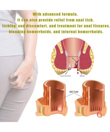 Organic Herbal Hemorrhoid Cream for Fast Relief - 1.76 Oz - Suitable for Adults, Pregnant & Postpartum Women - Buy Online on GoSupps.com