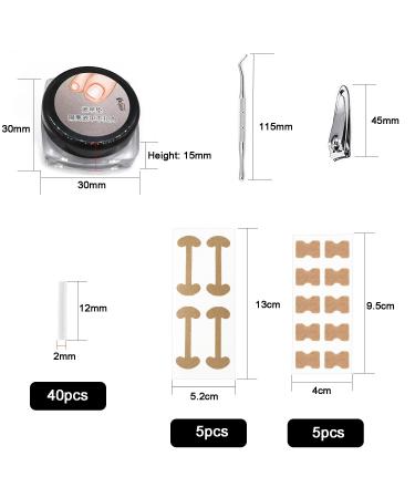 Ilamvie Ingrown Toenail Correction Set - 112 Piece C-Shaped Fill Padding Tool for Easy Ingrown Toenail Treatment - Buy Online on GoSupps.com