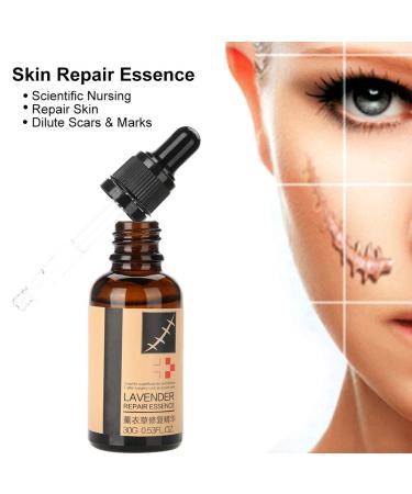 Lavender Scar Removal Serum for Stretch Marks & Skin Repair - Brightening Treatment Liquid - Buy Online on GoSupps.com