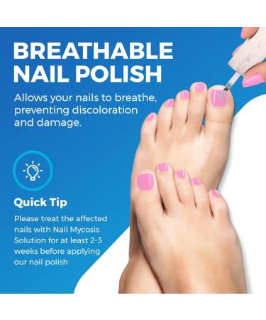 Ultimate Nail Fungus Treatment Set - Fungal nail treatment with Preventive Anti-fungal Shoe and sock Spray and pink Nail Polish - Buy Online on GoSupps.com