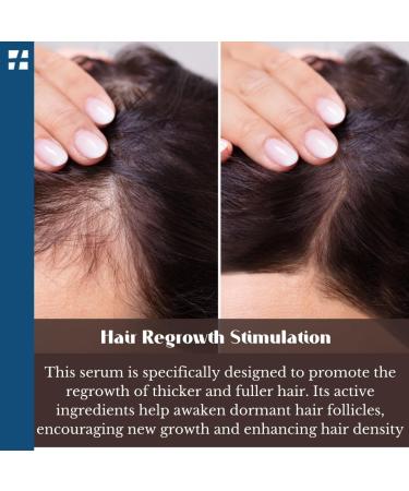 Turkeyana Plus Clinical Hair Repair Serum - Enhance Hair Regrowth & Revitalize Scalps | Natural Vegan Plant Stem Cells Biotin & Keratin - 1.69 fl Oz - Buy Online on GoSupps.com