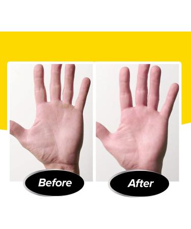 PediVac Electric Callus Remover with Built-In Vacuum - New Look | Removes Calluses & Dry Skin in Seconds | Mess-Free | 2000 RPMs | LED Light | 2 Speed Settings - Buy Online on GoSupps.com