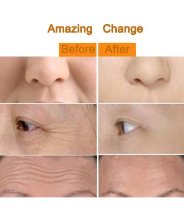 Amirce Electric Face Massage Roller for Eyes & Puffiness Relief - Buy Online on GoSupps.com