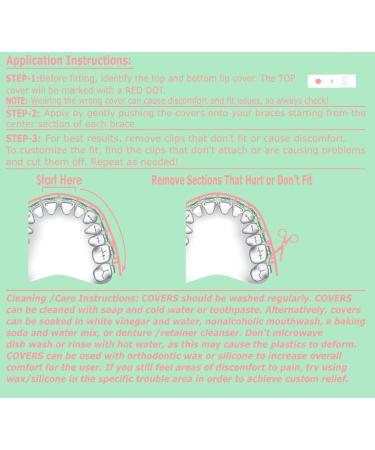 Tecnidentusa Clip-On Comfort Lip Shield - Braces Dental Wax Alternative - Buy Online on GoSupps.com