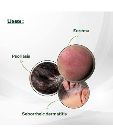 Psoriasis Coal Tar Salicylic Acid 100gm (3.52 oz) for Dry, Itchy Skin Relief - Buy Online on GoSupps.com