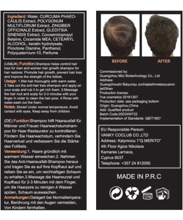 Anti-Hair Loss Shampoo 220mL - Effective Hair Growth Solution for Thinning & Breakage - Stop Hair Loss & Promote Fast Growth - Men & Women Treatment - Buy Online on GoSupps.com