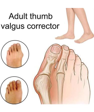 Wlype Toe Spreader - 2 Pieces Hallux Valgus Support for Foot Pain Relief & Pedicure Orthosis (Khaki M) - Adjustable Correction Aid for Day & Night Use - Buy Online on GoSupps.com
