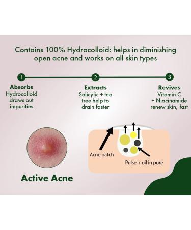 Shop Acne Pimple Patch | 36 Invisible Hydrocolloid Stickers for Overnight Pimple Relief - Buy Online on GoSupps.com