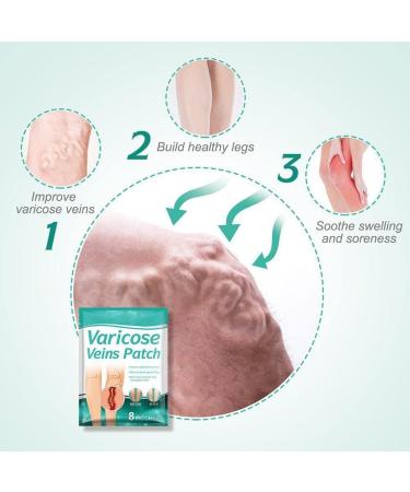 Wmool 8-Piece Varicose Veins Treatment | Vasculitis & Phlebitis Relief | 24 Sheets for Venous Fatigue & Limb Stiffness - Buy Online on GoSupps.com