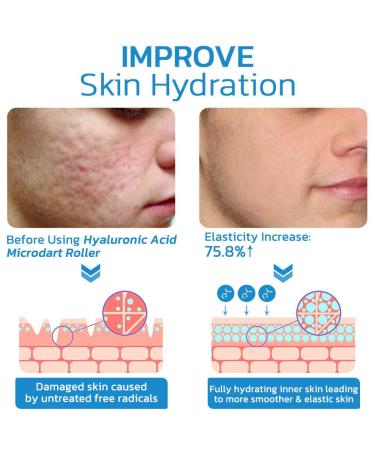 Flysmus Pockmarks Heal Hyaluronic Acid Microdart Roller - 10 Pcs | For All Skin Types | Improves Facial Lines and Wrinkles - Buy Online on GoSupps.com