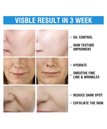 10% Glycolic Acid + 2% Salicylic Acid Peel Pads | BACHERI Facial Resurfacing Pads - Exfoliate Dark Spots & Acne | Vitamins B5 C E Allantoin - 55 Pads - Buy Online on GoSupps.com