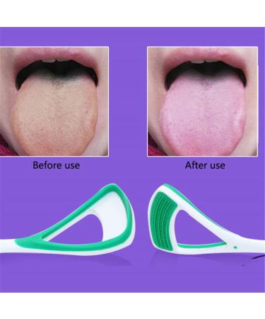 Dbtxwdd Tongue Cleaner - Eliminate Bad Breath & Bacteria | Deep Cleaning Micro Grooves | International Shipping - Buy Online on GoSupps.com