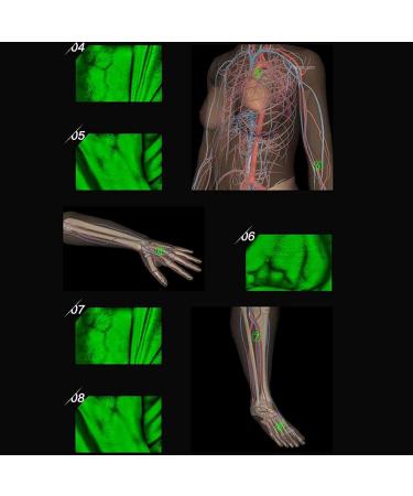 Adjustable Vein Viewers for Nurses | USB Camera Imaging IV for Accurate Venous Access | Ideal for Adults | Enhance Vein Puncture Success - Buy Online on GoSupps.com