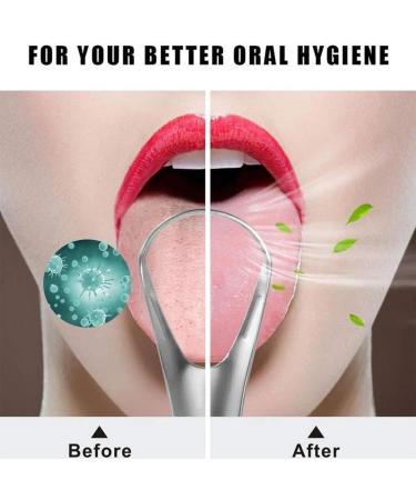 Silver Tongue Cleaner Brush - Stainless Steel Tongue Scraper for Bad Breath Relief - Portable Oral Care for Home & Travel - Buy Online on GoSupps.com