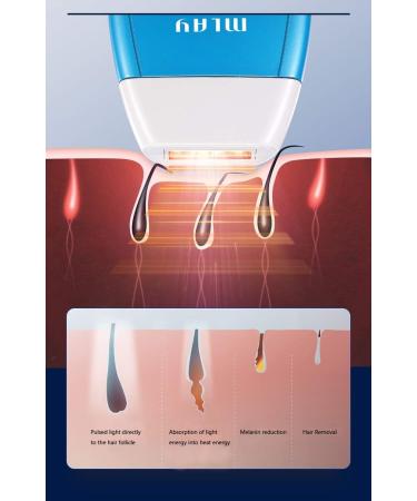 IPL Hair Removal Device with Laser Hair Remove+Skin Rejuvenation+Acne Clearance for Women and Men Body Face & Bikini Zone - Buy Online on GoSupps.com