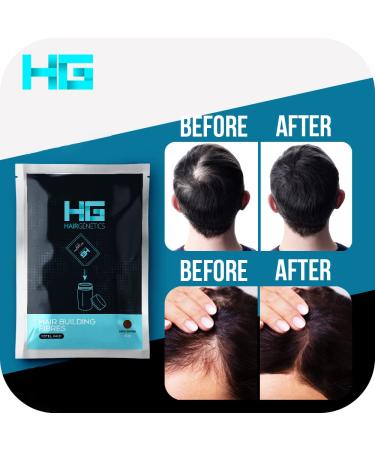 Hair Genetics Advanced Keratin Hair Fibers - Professional Hair Loss Concealer for Men & Women (Black 50g) - Money-Saving Refills - Buy Online on GoSupps.com