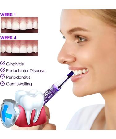 3PCs Liacsy Gingivawhite Gum Corrector & Purple Teeth Whitening Pen for Stain Removal | Enhance Gum Health - Buy Online on GoSupps.com