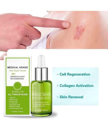 Goopgen Advanced Scar Repair Serum 30ml - Medical Grade Scar Removal Essence for All Types of Scars - Buy Online on GoSupps.com