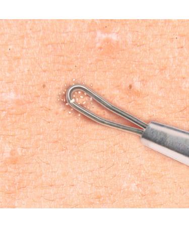 Beaute Galleria Double Loop Blackhead Remover - Acne & Whitehead Extraction Tool - Buy Online on GoSupps.com