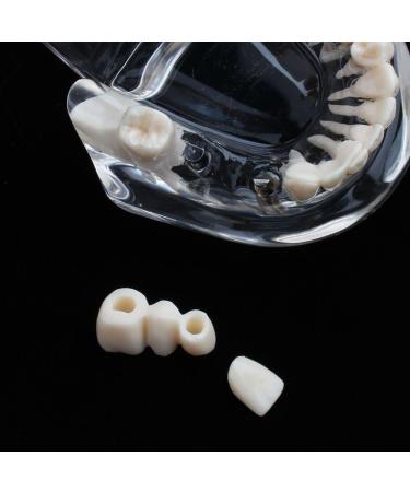 Boxwizard Tooth Model for Dentistry Students | Typodont Dental Diseases Teaching Aid - Adult Demonstration Tooth Model - Buy Online on GoSupps.com