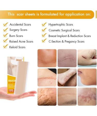 Silicone Scar Sheets 8 PCS Reusable Silicone Sheets for Scar Removal Professional Gel Scar Repair Treatment for Skin Trauma Surgery Burn Acne C-Section Scars White - Buy Online on GoSupps.com