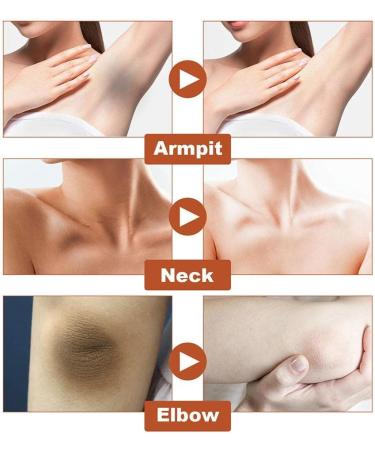 FOIDL Acantho Clear Therapy Spray - Acanthosis Nigricans & Dark Spot Remover - 30ml - Buy Online on GoSupps.com